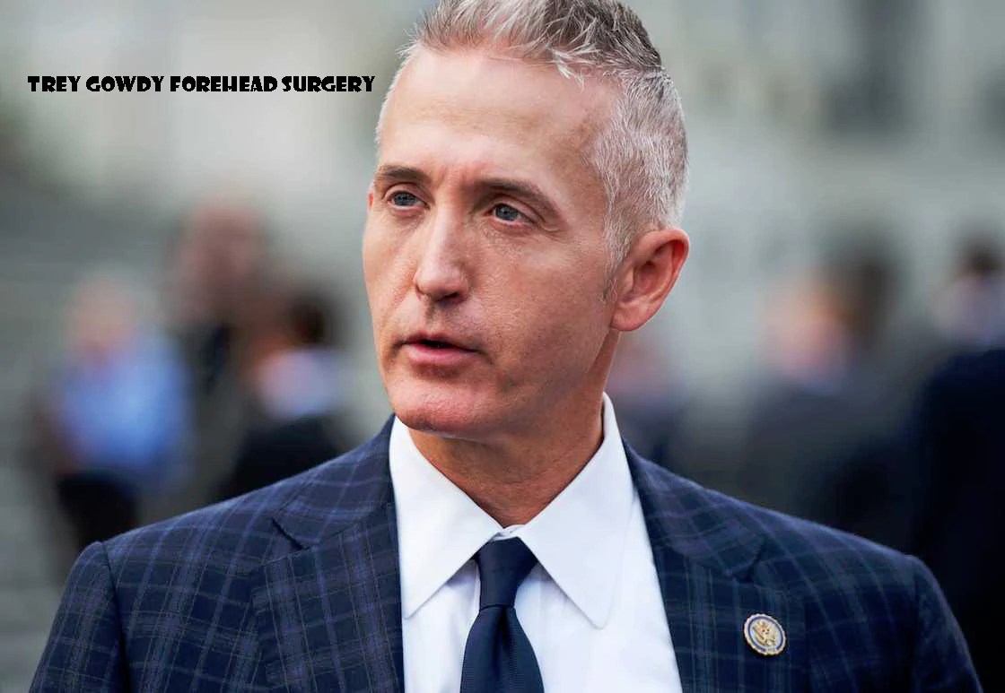 Trey Gowdy Forehead Surgery